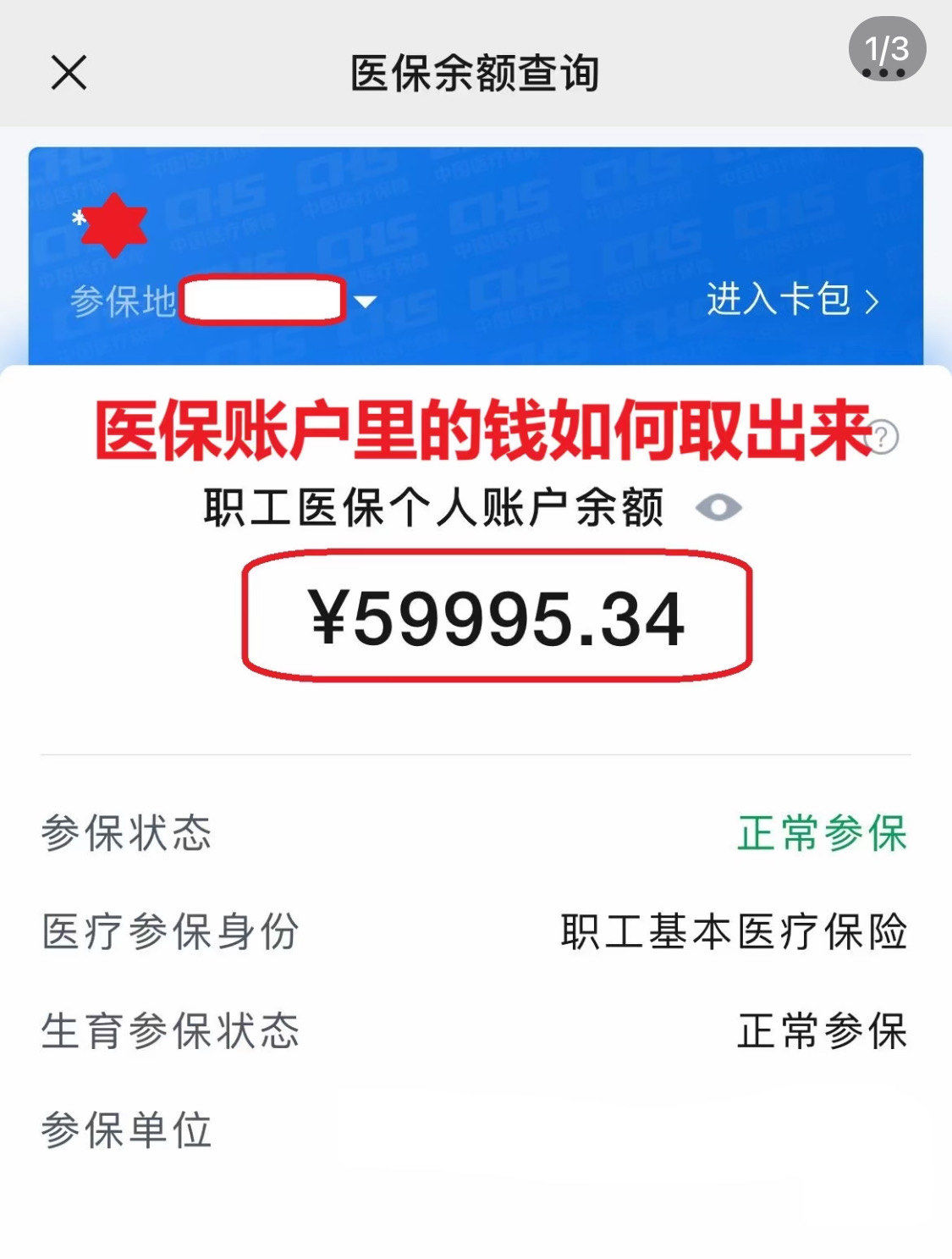 九江为什么医保卡里没有钱(为什么医保卡里没有钱还可以报销)