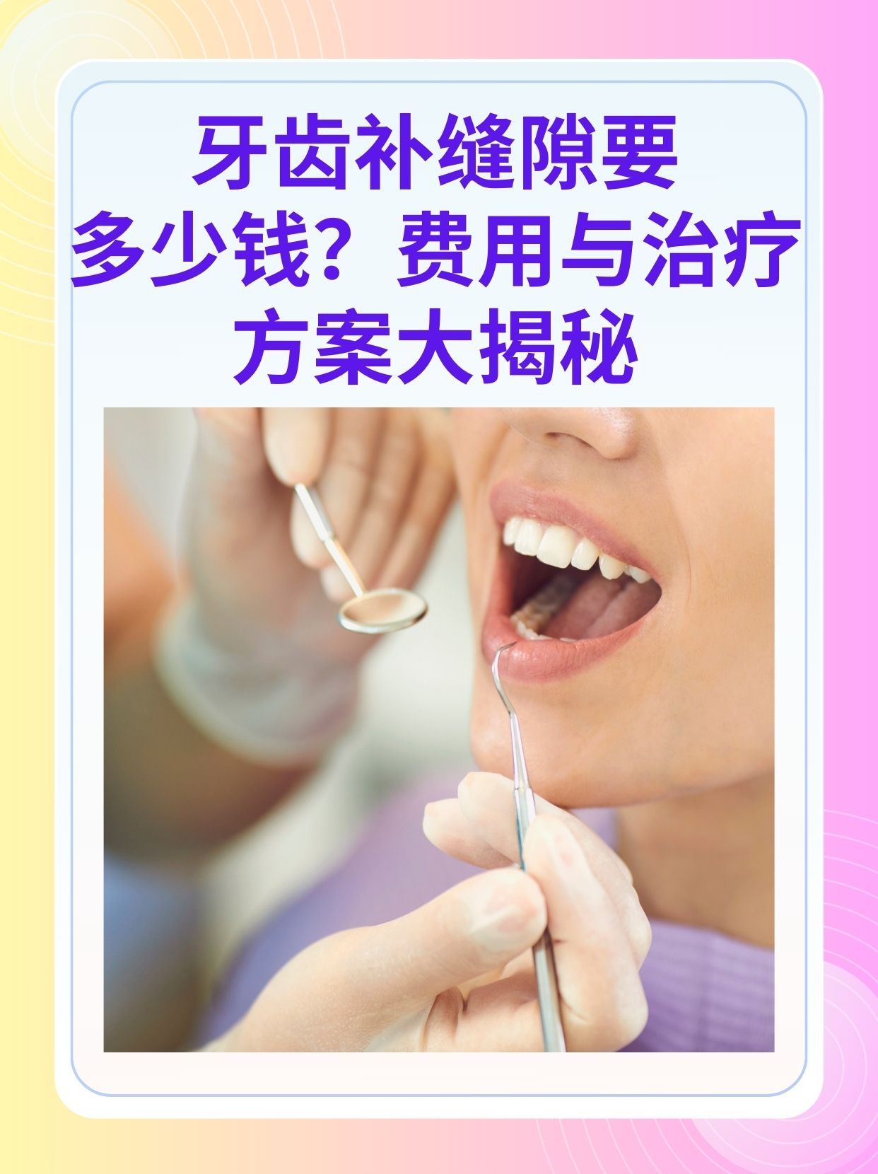 九江补牙医保可以报销吗(补牙医保可以报销吗 哪些可以报销呢)